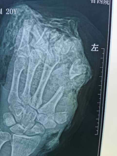 21点基本策略