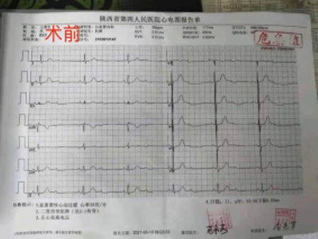21点基本策略