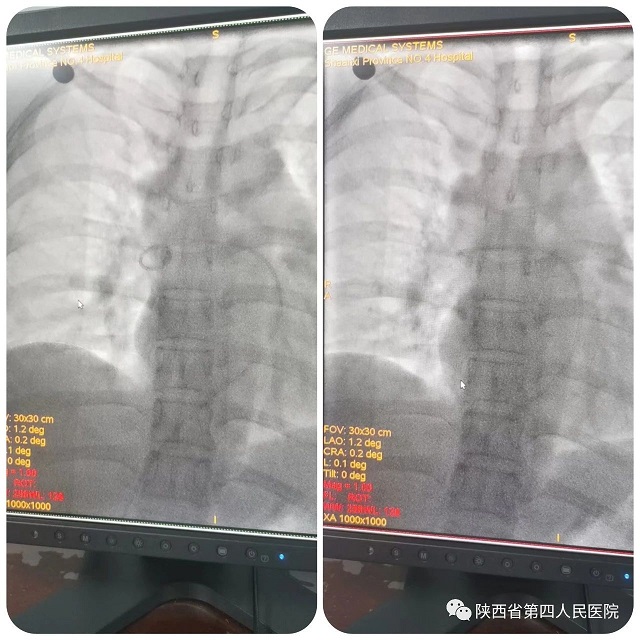 21点基本策略