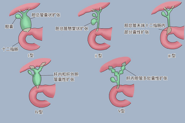 21点基本策略